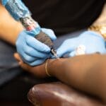 Psoriasis y la moda de los tatuajes 